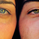 Illustration for article titled Testosterone in the Womb Affects How Our Faces Look After Puberty